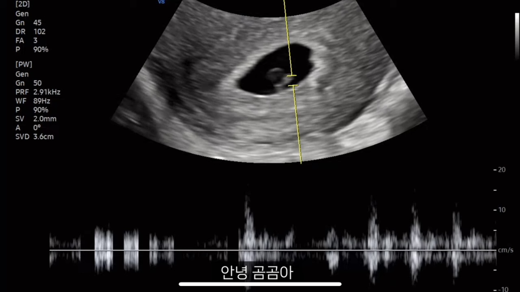 둘째 임신한 조두팔 | 인스티즈
