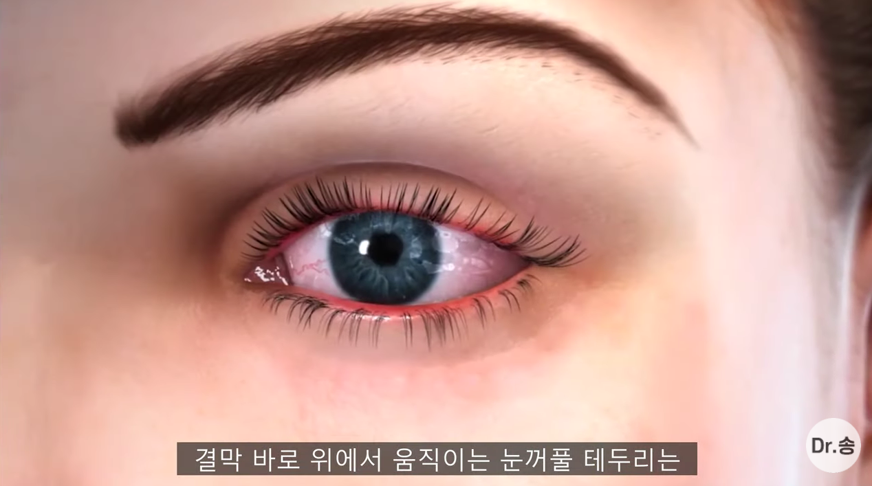 눈 충혈 없애는 법 - 만성 충혈은 이렇게 관리하는 겁니다 | 인스티즈