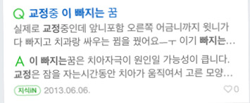 치아교정 하는 중 혹은 치아교정 하고 난 뒤 종종 꾸는 꿈 | 인스티즈