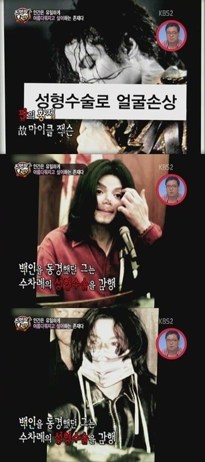 성형중독의 대명사가 되어버린 연예인 | 인스티즈