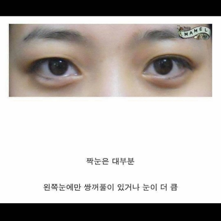 짝눈들 특징 | 인스티즈