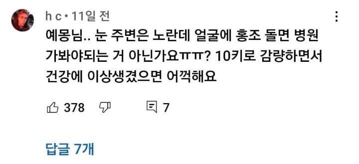 자꾸 사람들이 당뇨 걸린 거 아니냐고 하던 먹방유튜버 결말.jpg | 인스티즈