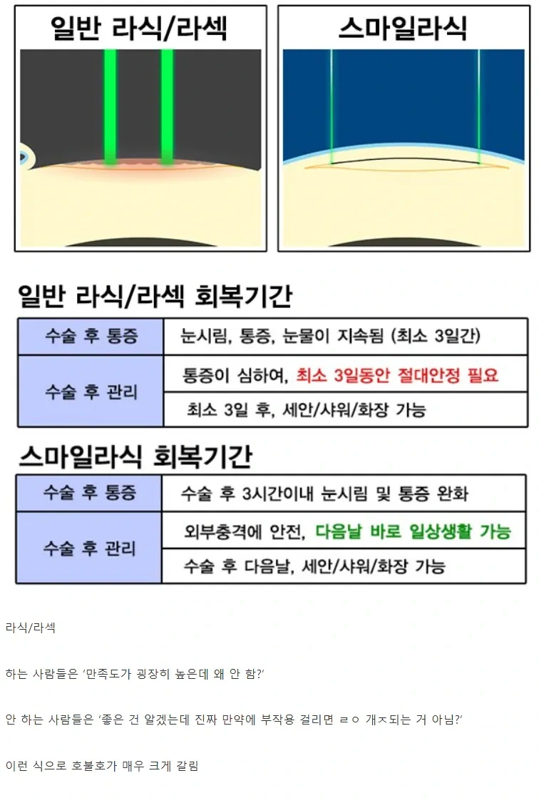 호불호 갈린다는 수술 | 인스티즈