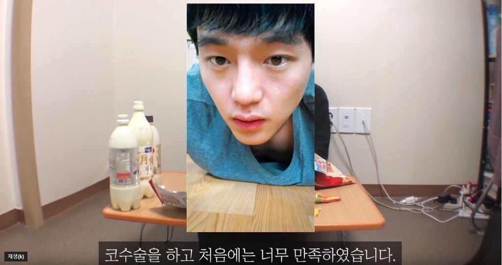코성형 6년차에 부작용 일어난 이야기.jpg | 인스티즈