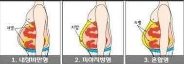 찌기 시작하면 위험한 살.jpgif | 인스티즈