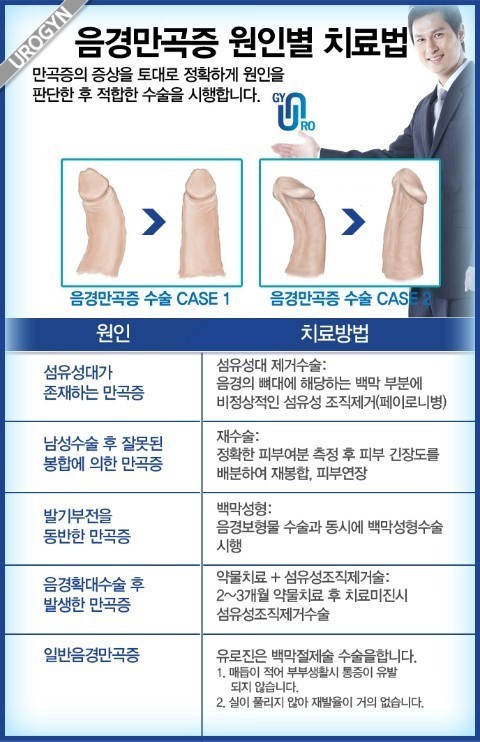 일부 남자들이 가지고 있는 음경만곡증 (페로니병) | 인스티즈