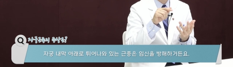 원인없는 자궁근종 증상 5가지 | 인스티즈