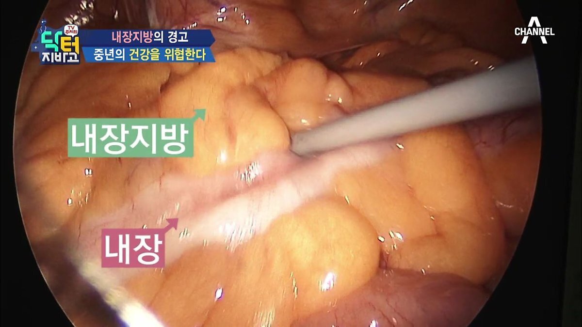 찌기 시작하면 위험한 살.jpgif | 인스티즈