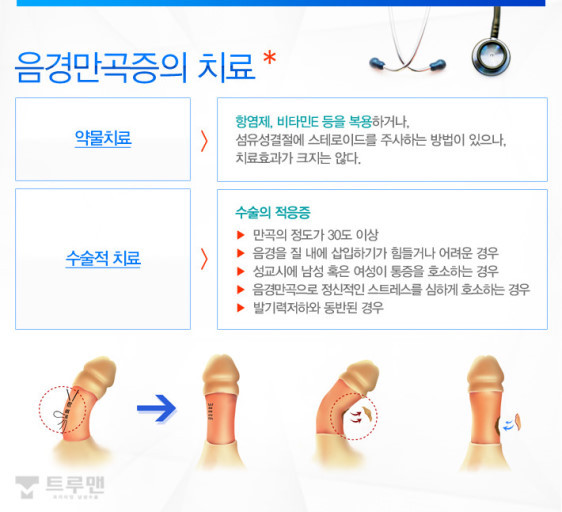 일부 남자들이 가지고 있는 음경만곡증 (페로니병) | 인스티즈