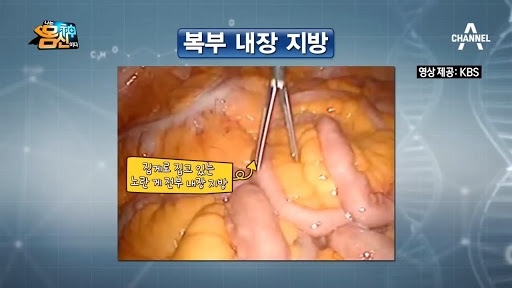찌기 시작하면 위험한 살.jpgif | 인스티즈