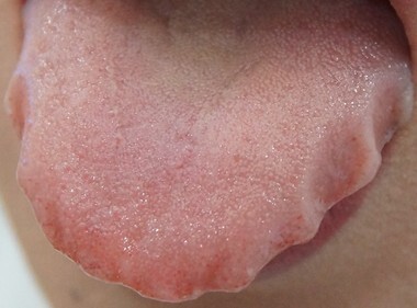 10명중 8명 정도가 겪는다는 몸의 이상반응 | 인스티즈