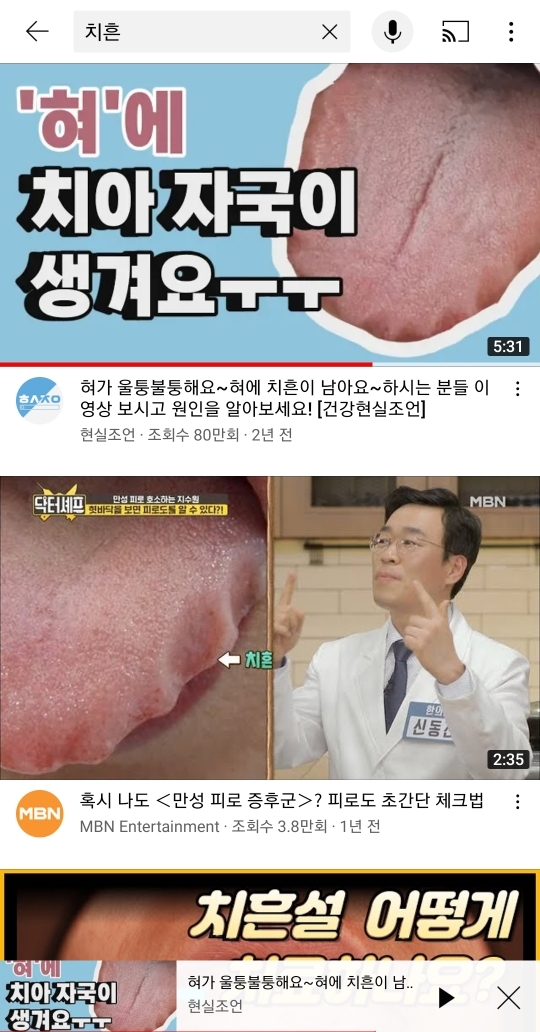 10명중 8명 정도가 겪는다는 몸의 이상반응 | 인스티즈