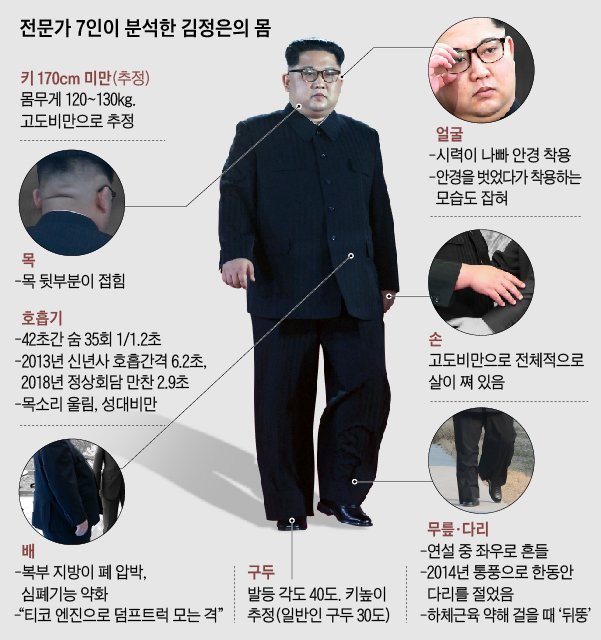 전문가 7명이 분석한 김정은의 몸 | 인스티즈
