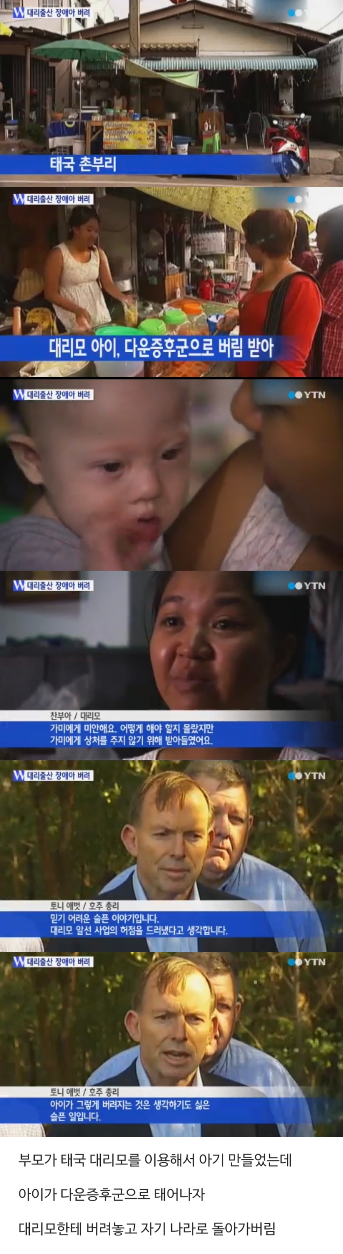 장애 있는 아이가 태어나자 대리모에게 버린 부부.jpg | 인스티즈