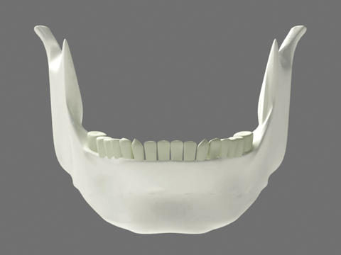 턱깎는 수술 과정.gjf | 인스티즈