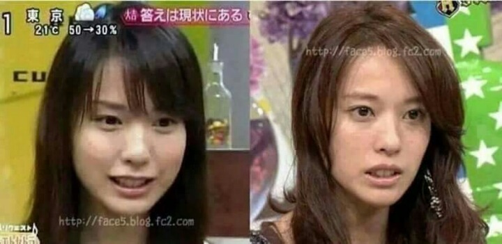 볼살 유무의 차이 | 인스티즈