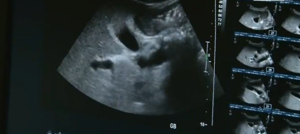 술을 안 마시면 헛것이 보이는 49살 남성의 몸 상태 | 인스티즈