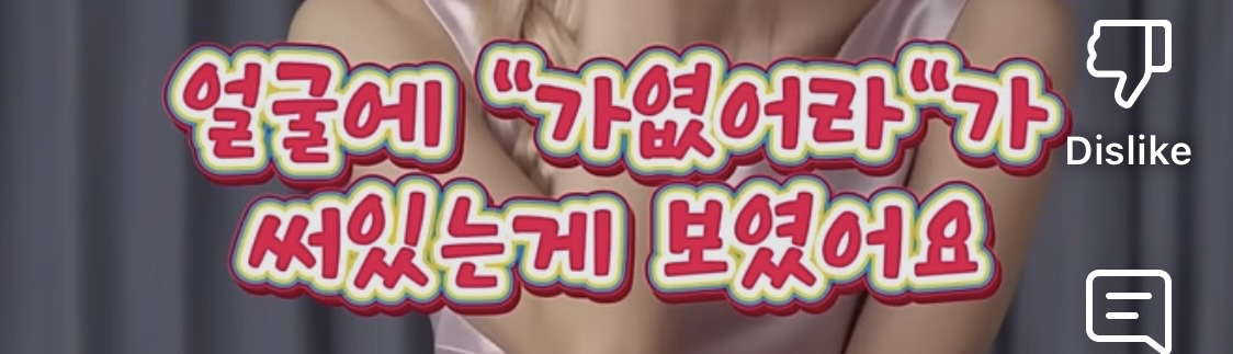 로제가 겪었던 인생 최악의 20분 | 인스티즈