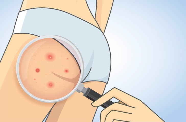 은근히 많은 사람들이 관리를 안하는 피부 부위.JPG | 인스티즈