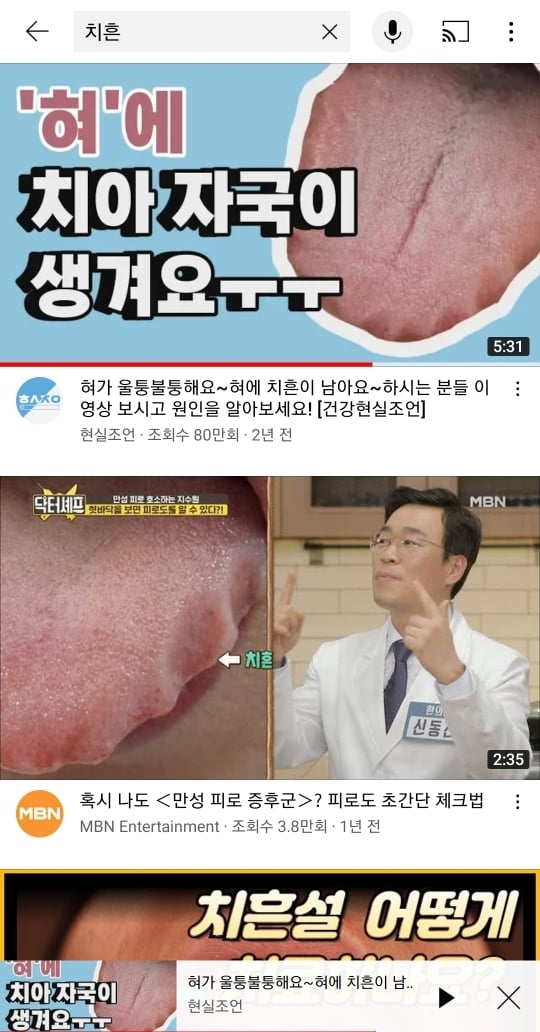 10명중 8명 정도가 겪는다는 몸의 이상반응 | 인스티즈