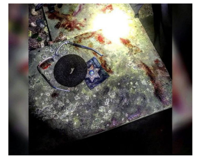 범인에게 폭행당해 피투성이가 됐음에도 끝까지 버틴 미국 여경 클래스(사진주의).jpg | 인스티즈
