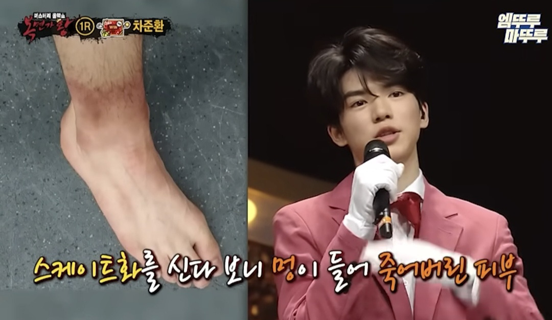 차준환 발목상태.jpg | 인스티즈