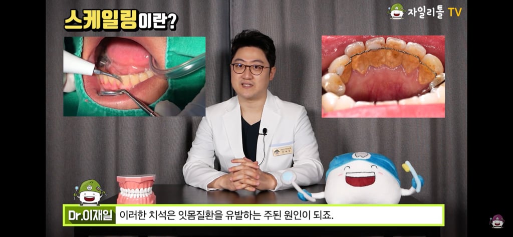 스케일링 꾸준히 해야하는 이유.jpgif | 인스티즈