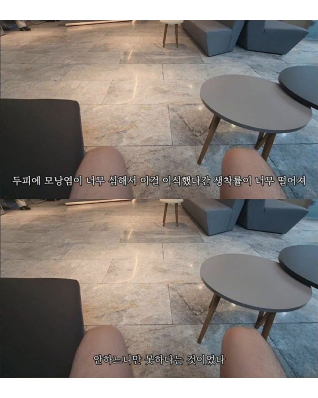 터키로 모발이식 받으러간 남성..jpg | 인스티즈