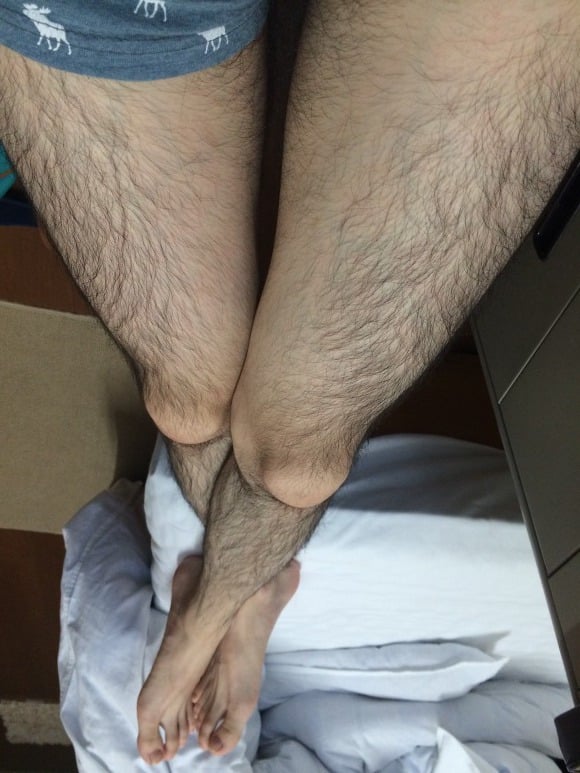 남자 브라질리언 왁싱 올 누드 + 종아리 왁싱 받고 온 후기 | 인스티즈