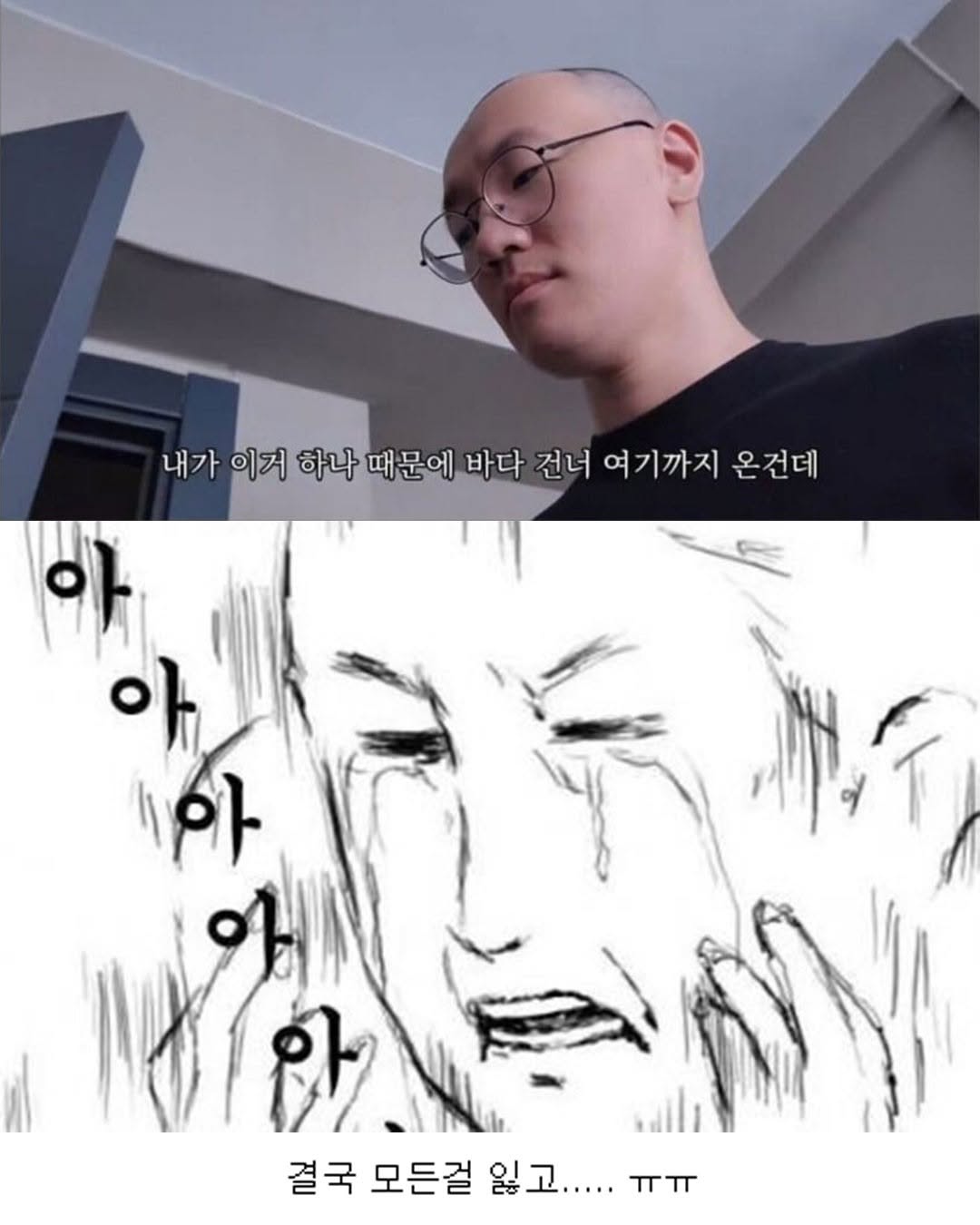 터키로 모발이식 받으러간 남성..jpg | 인스티즈