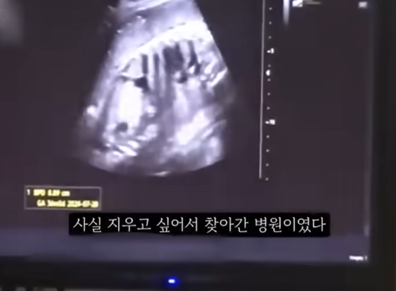 '36주 낙태' 20대女, 50대 교제남이 수술비 내주고 떠났다 | 인스티즈