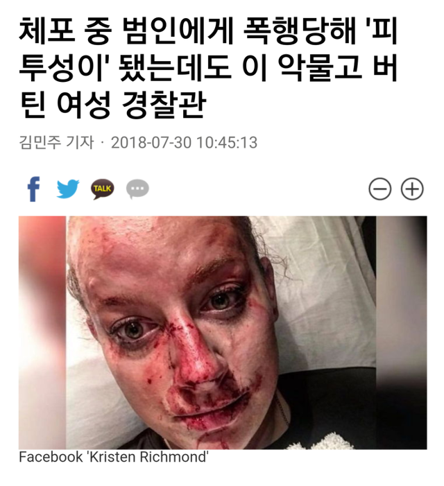 범인에게 폭행당해 피투성이가 됐음에도 끝까지 버틴 미국 여경 클래스(사진주의).jpg | 인스티즈