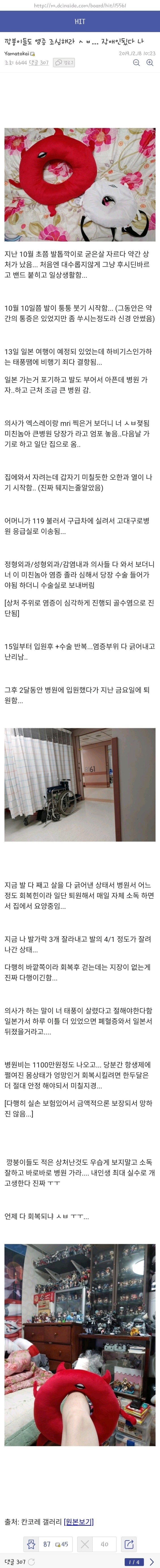 굳은살 자르다 발가락 절단한 디씨인 | 인스티즈