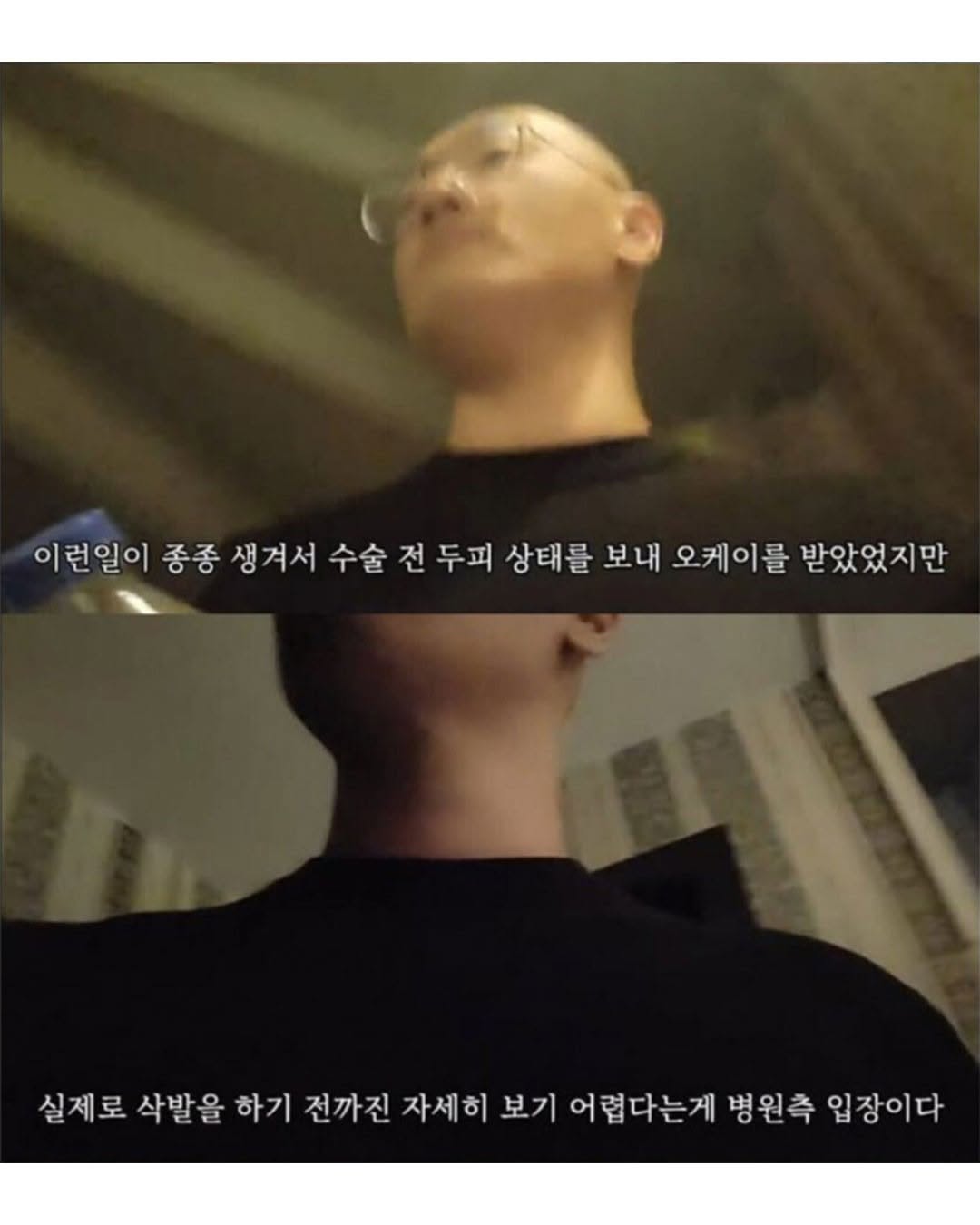 터키로 모발이식 받으러간 남성..jpg | 인스티즈