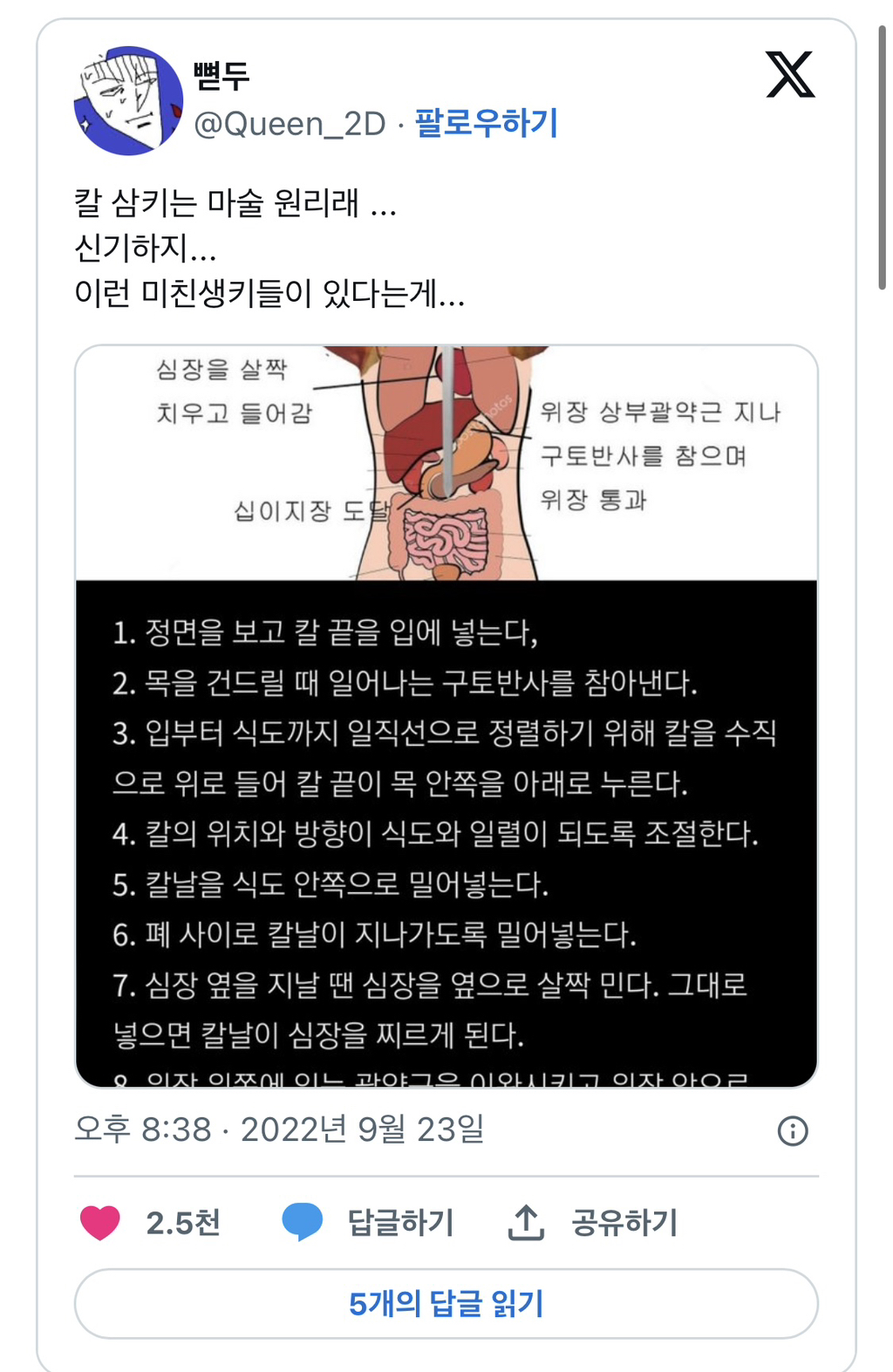 알티타는 충격적인 칼 삼키는 마술의 원리 .. jpg | 인스티즈