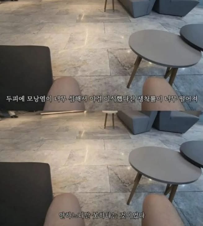 터키로 모발 이식 하러 간 사람에게 일어난 일 | 인스티즈