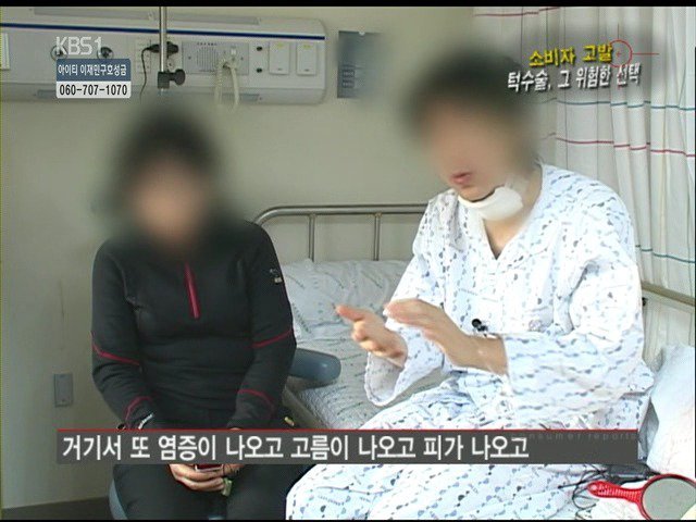 성형외과 종사자들이 말하는 부작용 위험높은 수술 쓰리톱 (혐오주의) | 인스티즈