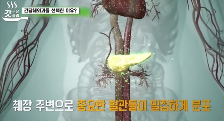 췌장암 검사 꼭 해야 하는 이유 | 인스티즈