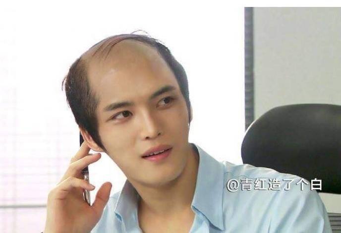 머리숱의 중요성.jpg | 인스티즈