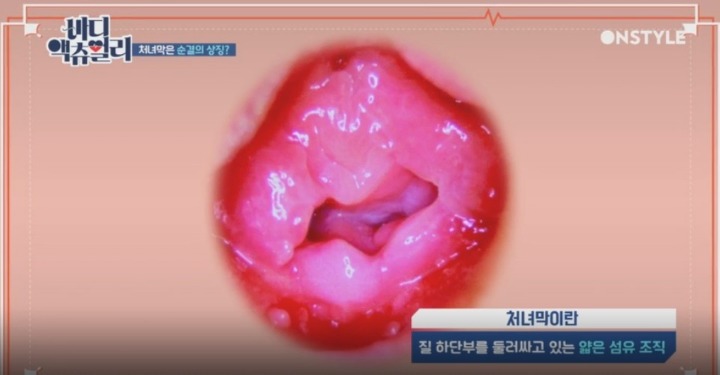 실제 처녀막 사진.jpg | 인스티즈