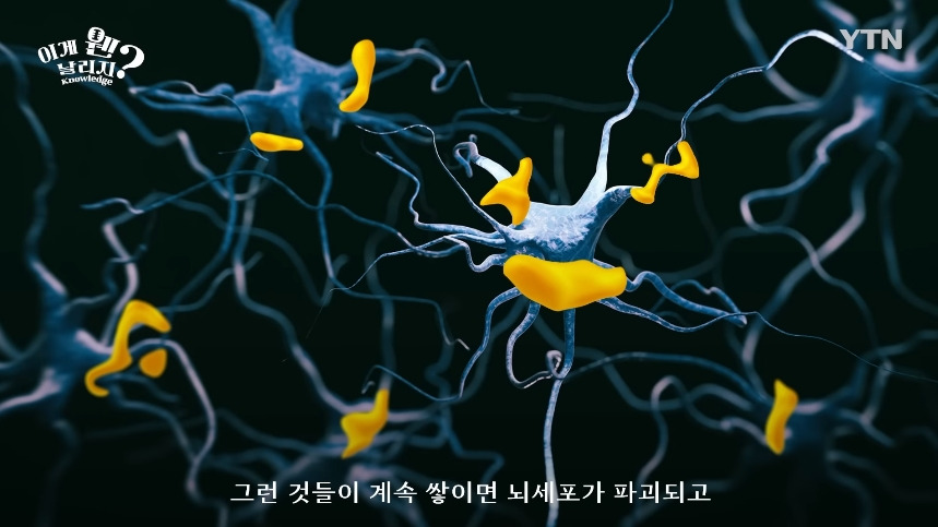 혈당 관리 안하면 빨리 늙는 이유.jpg | 인스티즈