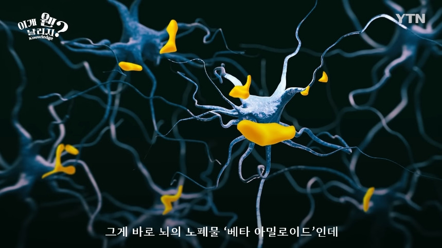 혈당 관리 안하면 빨리 늙는 이유.jpg | 인스티즈