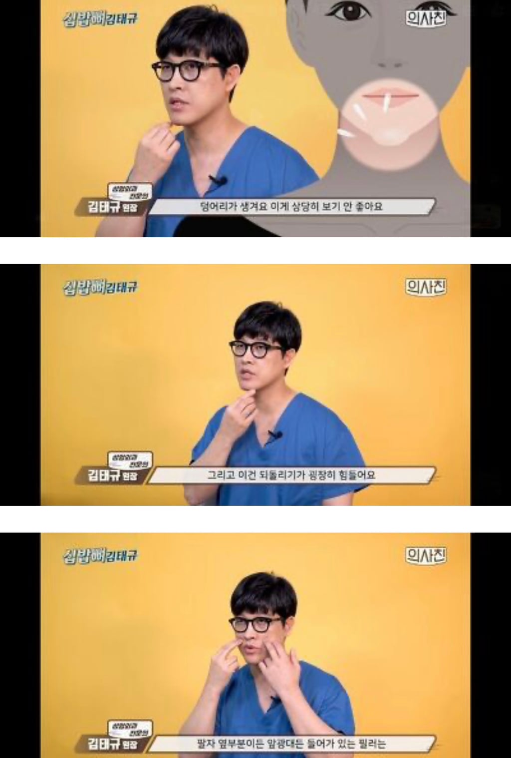 [필러부작용] 의사피셜 필러 절대 맞지 말아야 할 4군데 | 인스티즈