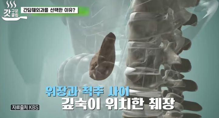 췌장암 검사 꼭 해야 하는 이유 | 인스티즈