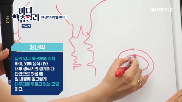 실제 처녀막 사진.jpg | 인스티즈