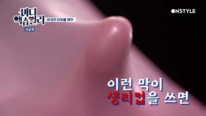 실제 처녀막 사진.jpg | 인스티즈