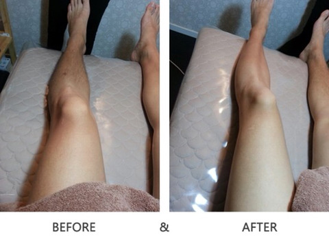 남자 다리털 왁싱 | 인스티즈