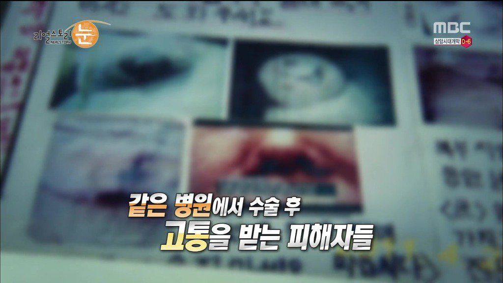 확인된 피해자만 50명이 넘는 싸이코 성형외과 의사 | 인스티즈