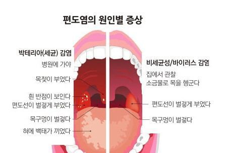 군대가면 많이 걸리는 병들 .jpg | 인스티즈