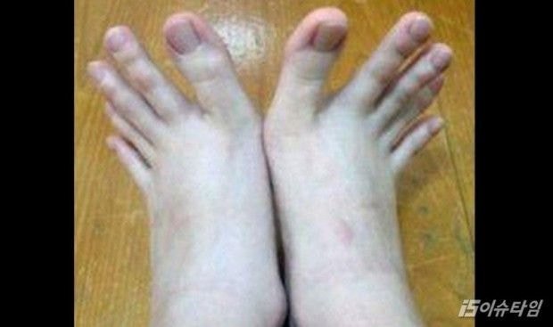 손가락처럼 발가락이 긴 사람.jpg (긴발사진있음) | 인스티즈